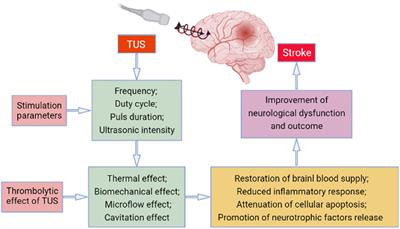 The Updated Role of Transcranial Ultrasound Neuromodulation in Ischemic Stroke: From Clinical and Basic Research